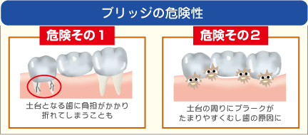 ブリッジの危険性